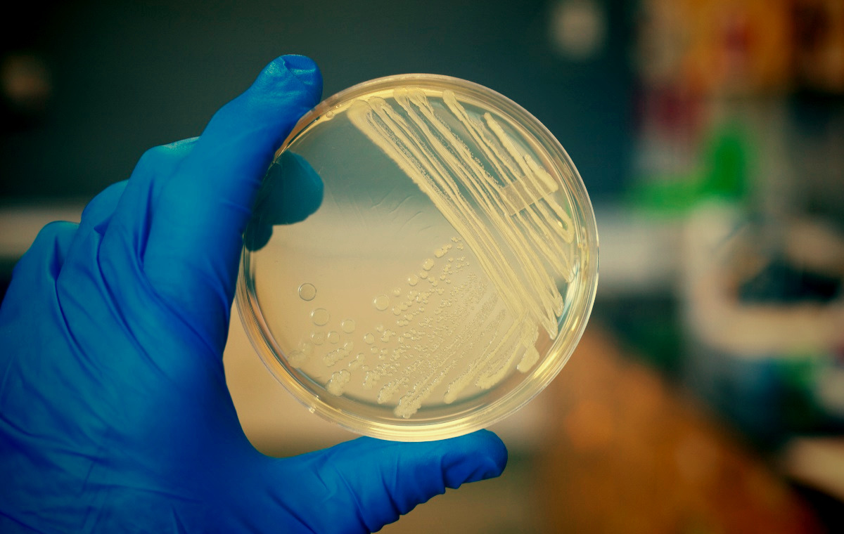 What Drugs Are Used for Joint Pain Treatment Repharm